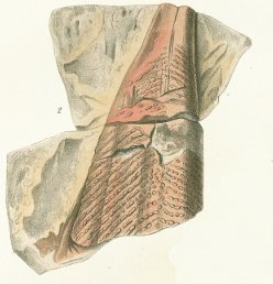 Oracanthus milleri Tafel 3 fig. 2